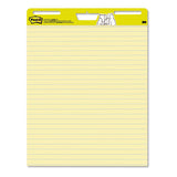 Self Stick Easel Pads, 15 X 18, White, 20 Sheets-pad, 2 Pads-pack